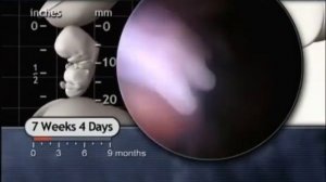 7 хафталик эмбрион онлайн трасляция