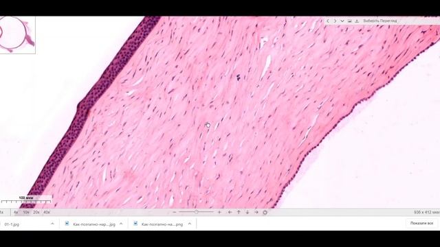 Препарат рогівка ока. Багатошаровий плоский незроговілий епітелій. смотреть онлайн