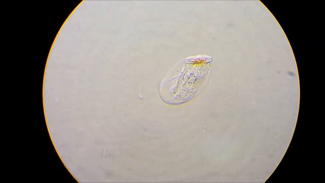 Амёба Thecamoeba striata смотреть онлайн