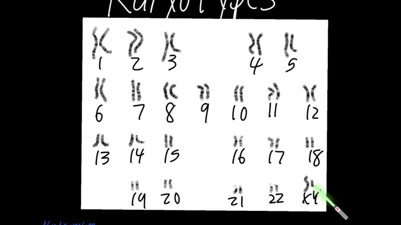 Karyotypes and Nondisjunction Made Easy!!! смотреть онлайн