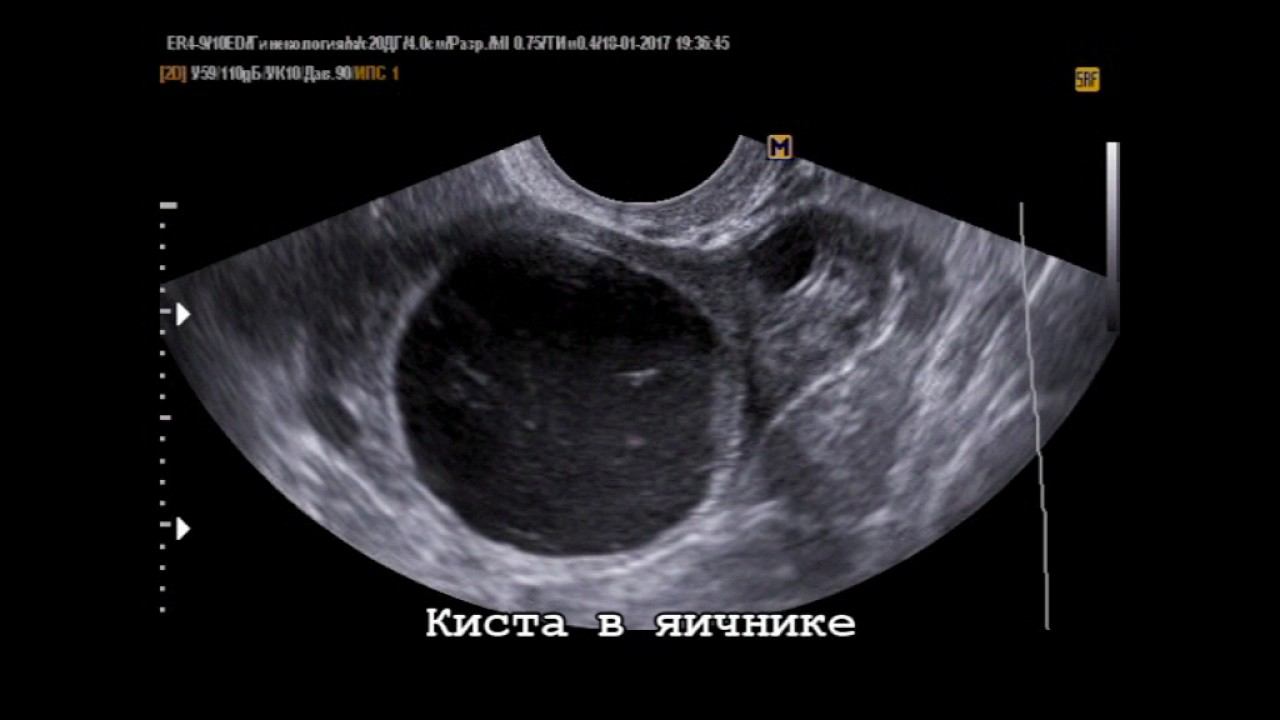 Акустический поток смотреть онлайн