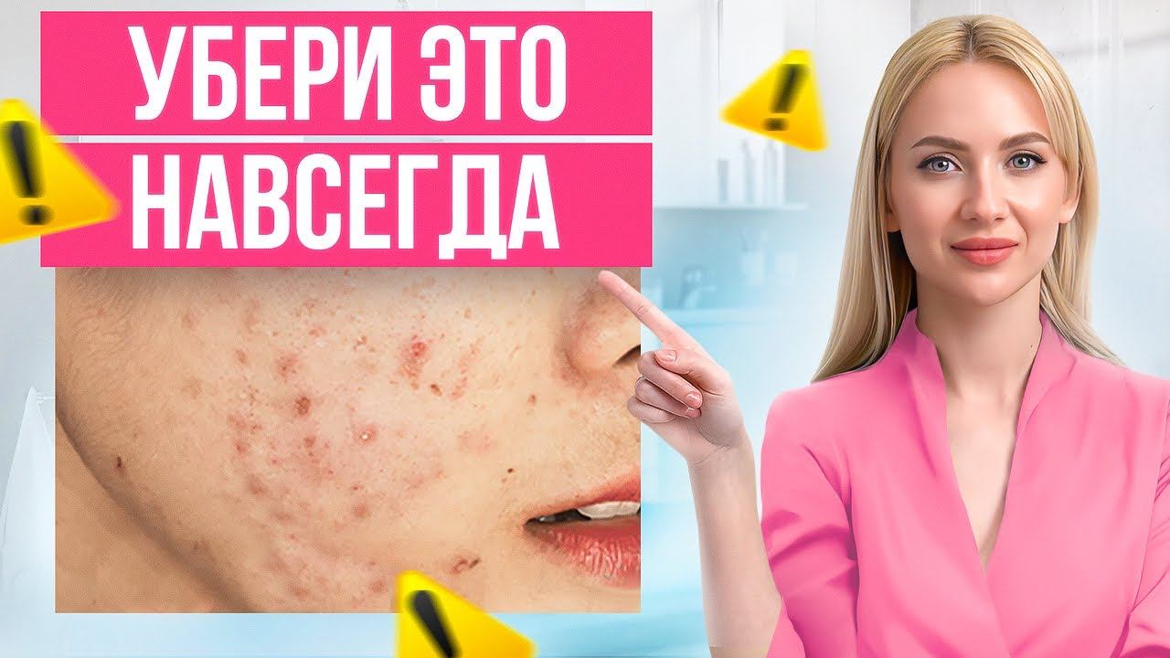 Как убрать темные пятна и рубцы от акне? Этот способ РАБОТАЕТ! смотреть онлайн