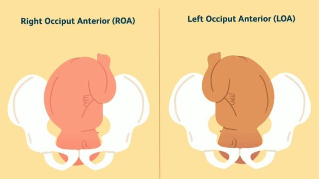 Normal Delivery Baby Position| Cephalic|Vertex|Head Down Position Malayalam смотреть онлайн