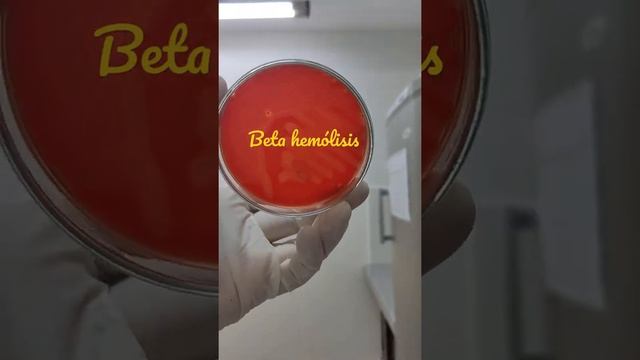 Beta hemólisis en Agar Sangre смотреть онлайн