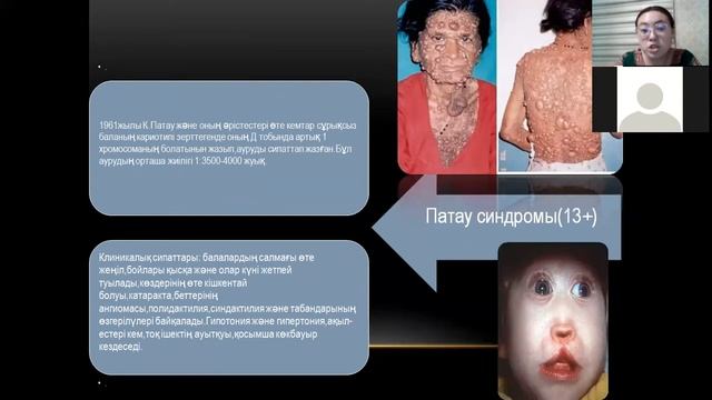 ZOOM, хромосомалык аурулар смотреть онлайн