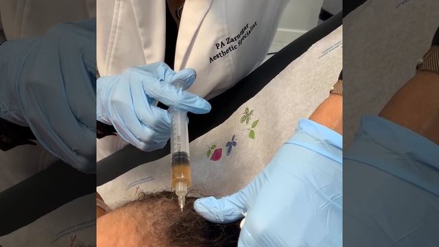 Essential Aesthetics | Platelet-Rich Plasma Treatment смотреть онлайн