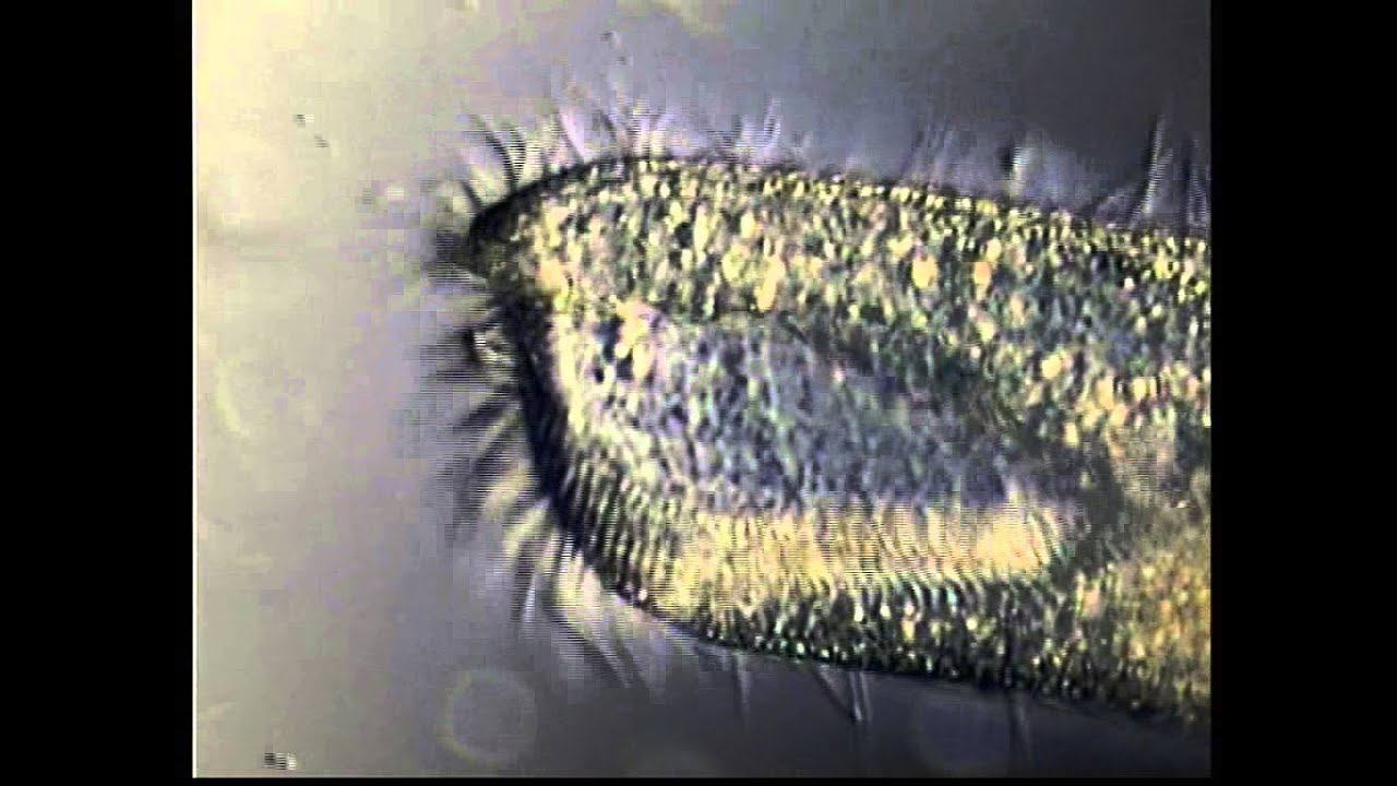CONDYLOSTOMA CILIADO смотреть онлайн