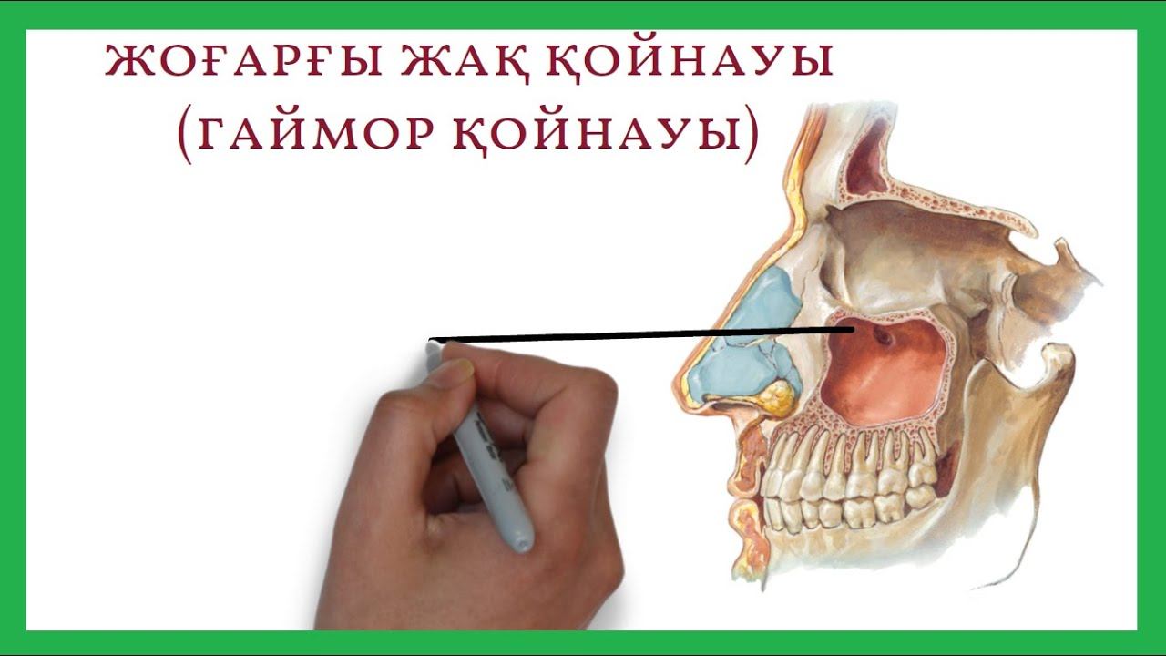 Жоғарғы жақ қойнау анатомиясы. (Гаймор қойнауы) смотреть онлайн