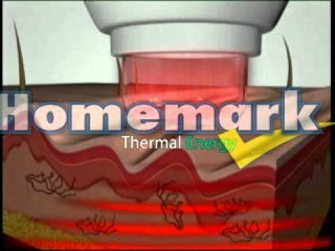Derma Wand смотреть онлайн