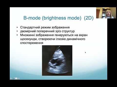 Види датчиків та режими візуалізації смотреть онлайн