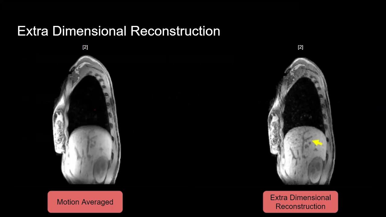 EE225E Sp21 Principles of MRI Lecture 29 смотреть онлайн