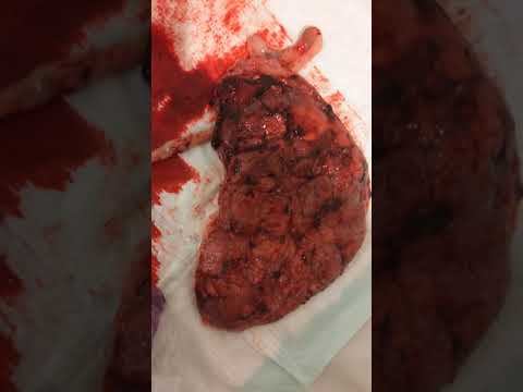 Placenta Exam смотреть онлайн