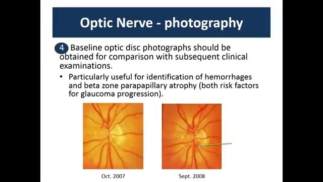 Best Approach to Diagnosing Glaucoma Progression смотреть онлайн