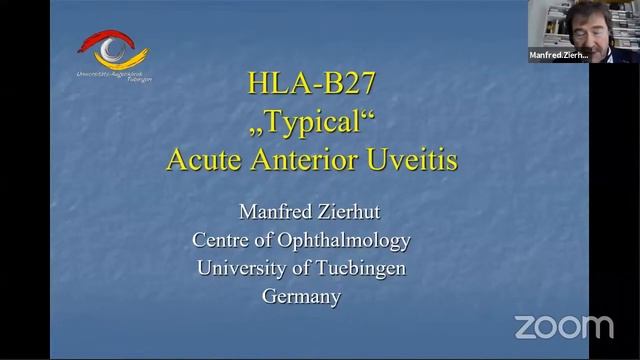 Uveitis Webinar - 6 (HLA-B27 and uveitis) смотреть онлайн