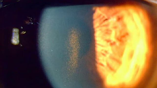 Un ophtalmo ! Pourquoi? смотреть онлайн