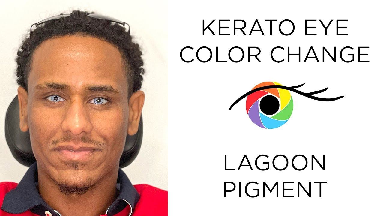 Eye Color Change from Brown to Light Blue (Lagoon Pigment) смотреть онлайн