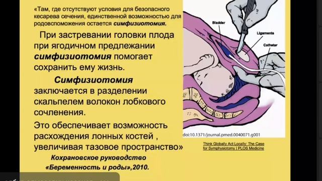 Лекция 6 "Узкий таз" 12.10.23 смотреть онлайн