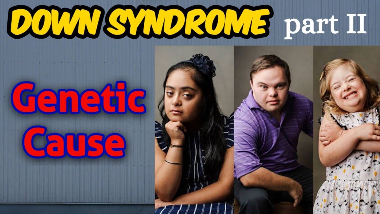 Genetics Behind Down Syndrome | Trisomy 21 in Human | Robertsonian Translocation | смотреть онлайн