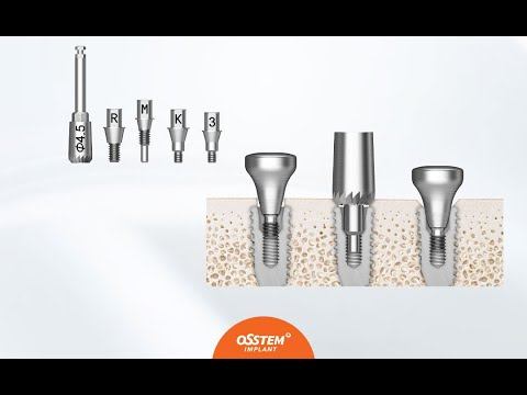 OSSTEM Bone Profiler смотреть онлайн