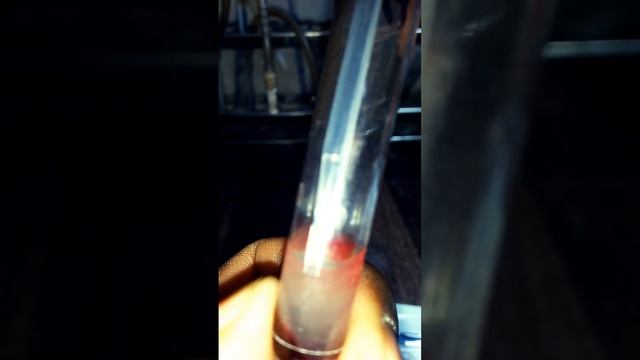 hepatitis test|HBsAg|antiHCV|chromatography|test procedure|serology|screening|blood banking|viral смотреть онлайн