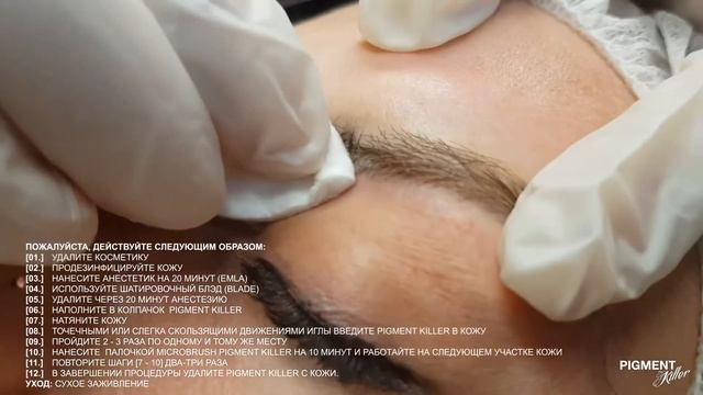 Удаление пигмента с использованием Pigment Killer