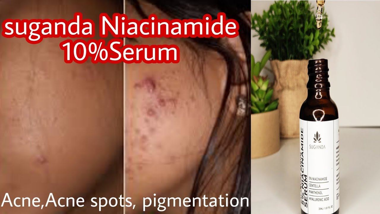 Suganda 10% Niacinamide Face Serum for Hydrating Skin, For Acne, Acne Marks & Oil Balancing Serum смотреть онлайн