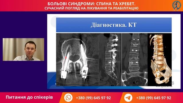 Лекція проф. Якова Фіщенко на тему "Дегенеративний спондильоз" смотреть онлайн
