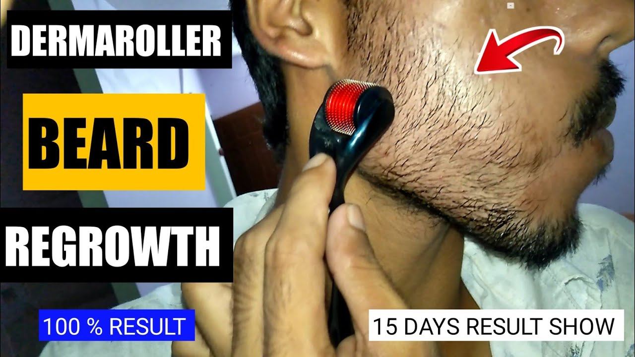 How to use derma roller for beard growth | Derma roller beard regrowth | Tips for beard growth смотреть онлайн