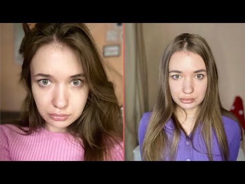 О последствиях приема миорелаксанта «Сирдалуд», о массаже, о ботоксе…