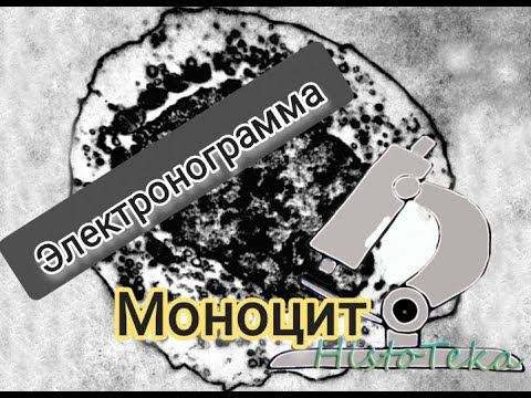 МОНОЦИТ (электронограмма) смотреть онлайн