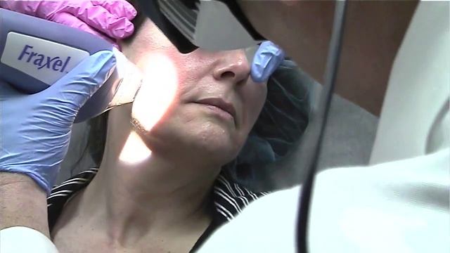 Fraxel Laser Treatment Demonstration - Dr. Bernstein in Philadelphia смотреть онлайн