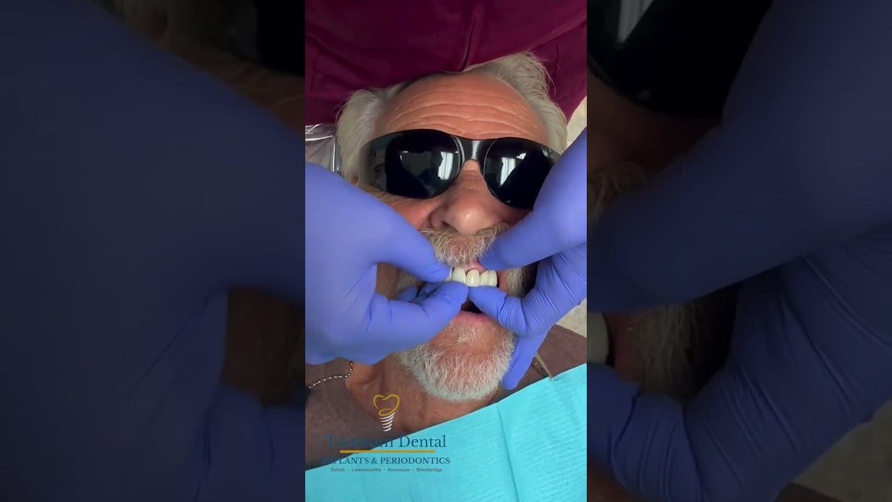 TITANIUM Dental - New Tooth, New Smile #teeth #dentist #dentalimplant смотреть онлайн