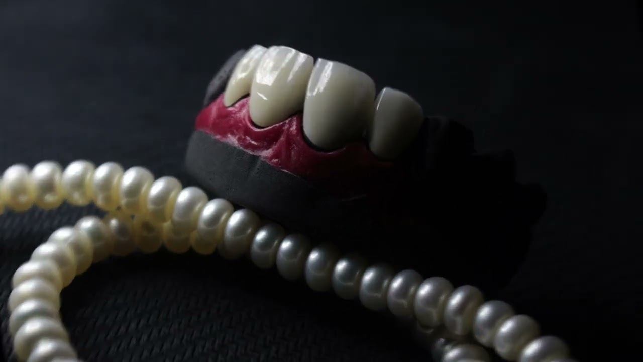 стоматология виниры эмакс эстетика коронки зубы анатомия зубов Блич Санкт Петербург смотреть онлайн