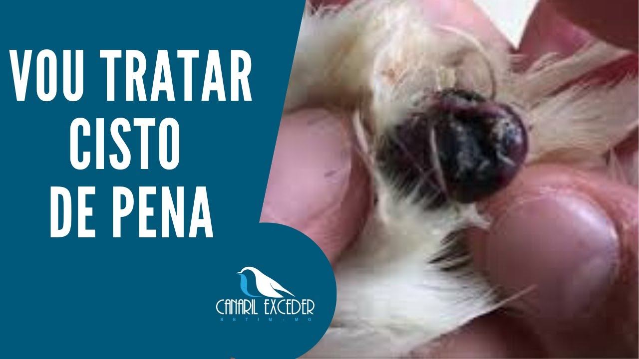 VOU TRATAR CISTO DE PENA смотреть онлайн