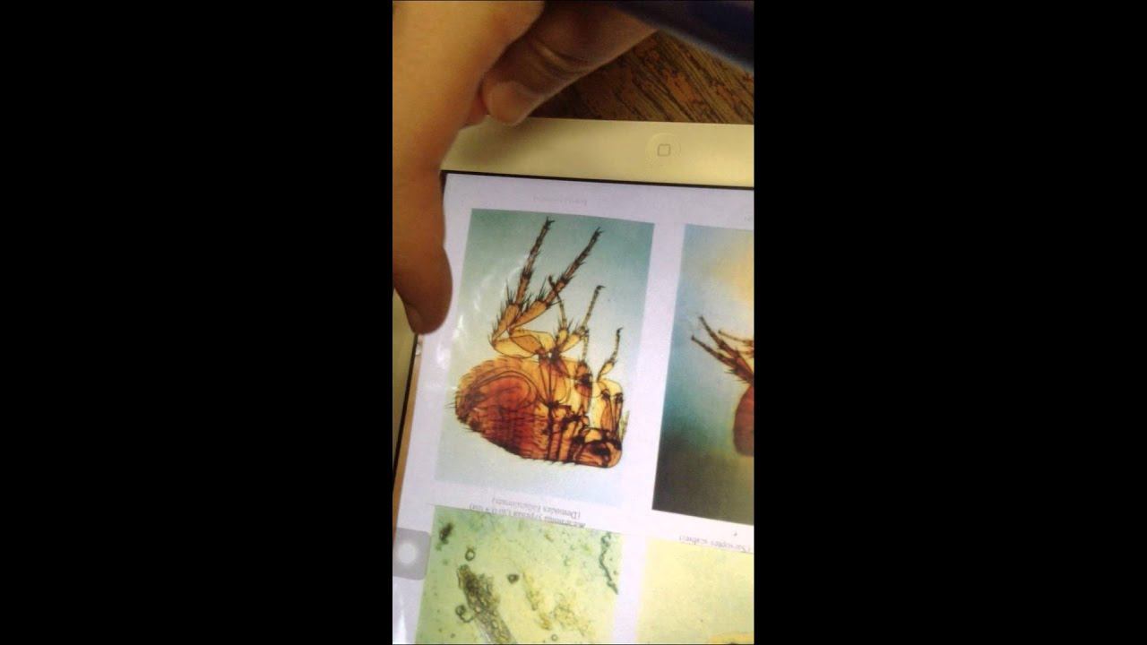 Parasitology 5 смотреть онлайн