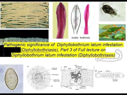 Pathogenic Significance, Clinical Signs And Diagnosis Of Diphyllobothrium Latum Infestation