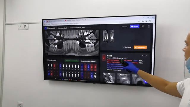 Отзыв о работе в Diagnocat