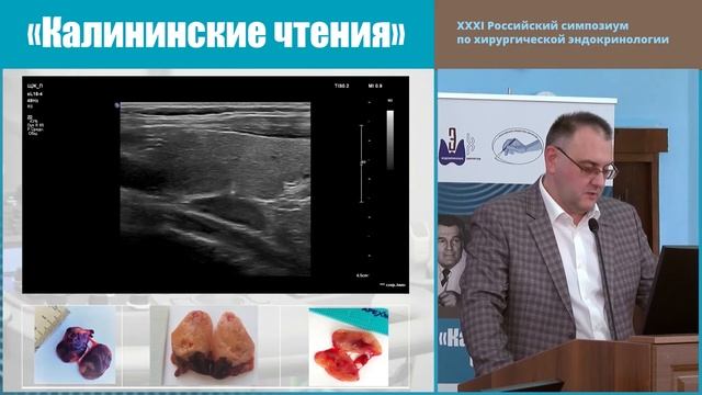УЛЬТРАЗВУКОВОЕ ИССЛЕДОВАНИЕ ПРИ ПОЭТАПНОЙ ПАРАТИРЕОИДЭКТОМИИ смотреть онлайн