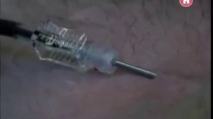 Наука 2 0. Большой скачок. Тайна крови