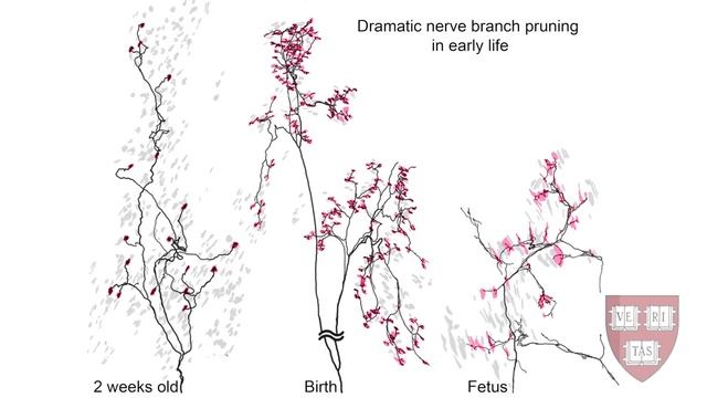 Synaptic Pruning in the Developing Nervous System смотреть онлайн