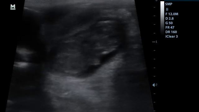 201509231435480007SMP смотреть онлайн