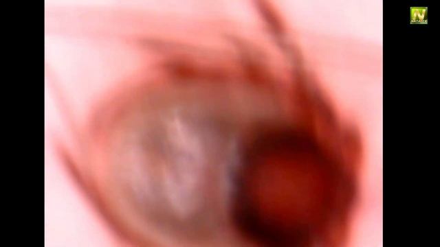 [Natalex] Этот клещ размером с четверть спичечной головки, а выглядит как огромный монстр... смотреть онлайн