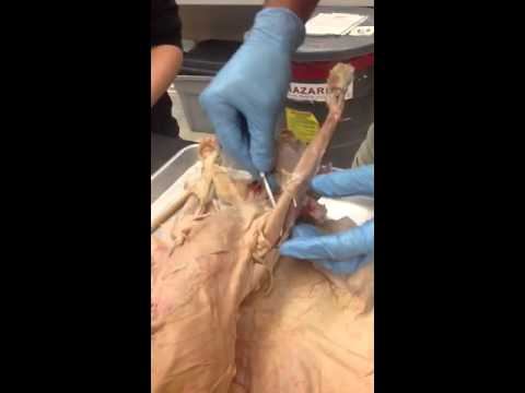 Triceps смотреть онлайн