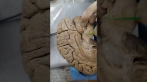Анатомия головного мозга человека