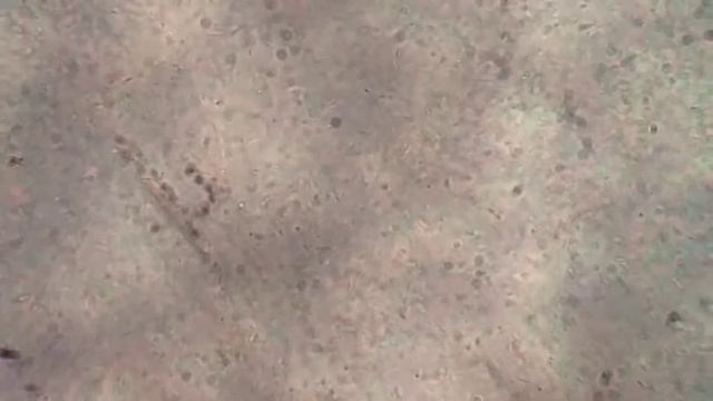 Bacilli Motility... смотреть онлайн