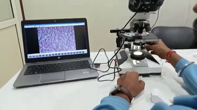 Labcare Digital Microscope With Camera Attachment @labcareexportsindia2480 смотреть онлайн