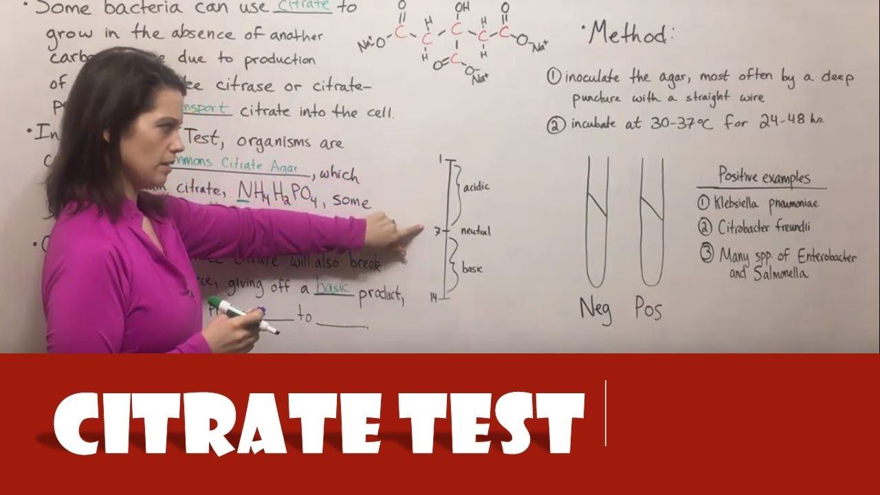 Citrate Test смотреть онлайн