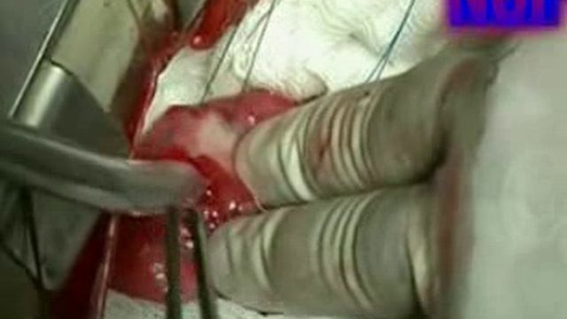 Паразиты внутри нас смотреть онлайн