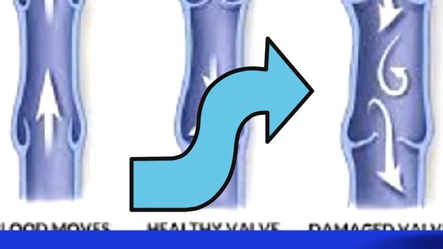 Varis, Varis Muayenesi, Sağlık, Prof.Dr.Serdar Akgün смотреть онлайн