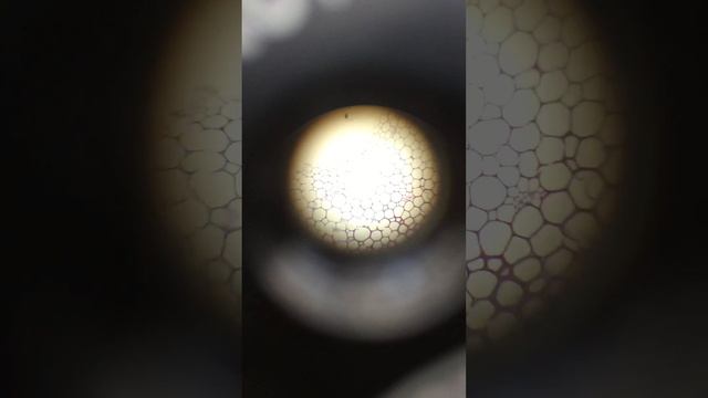 SCLERENCHYMA UNDER MICROSCOPE смотреть онлайн